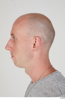Photos Reece Griffiths bald head 0002.jpg